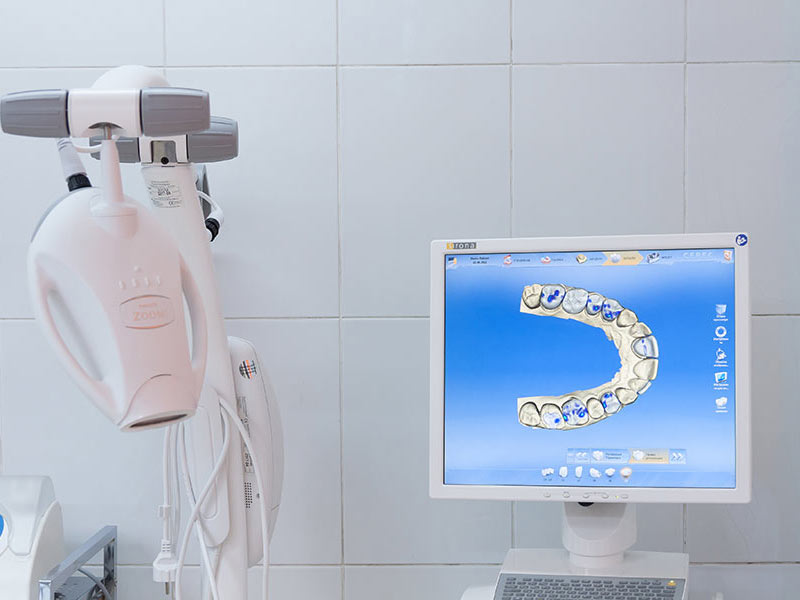 Диагностика зубов в Екатеринбурге